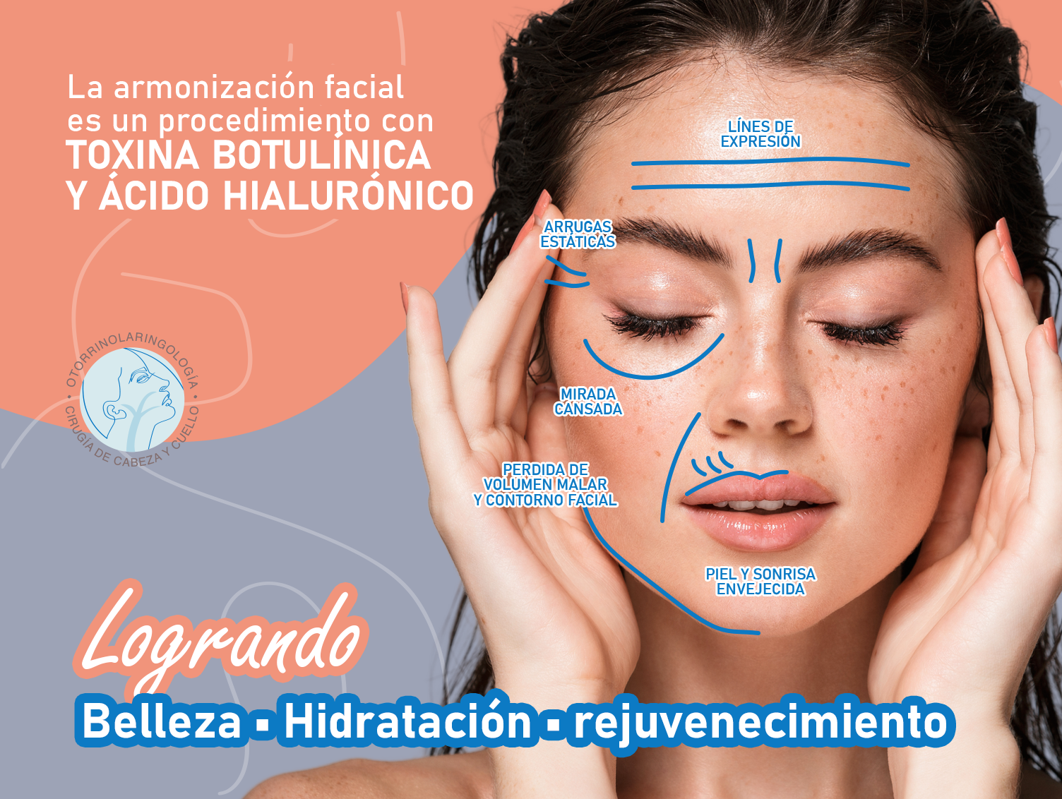 ¿Qué es la armonización facial?